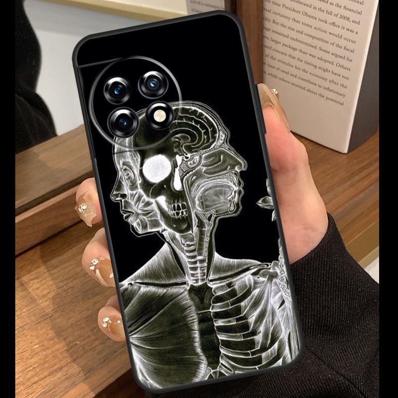 Medical Skeleton Anatomy Case For OnePlus 15 R 13T 13R 12R 10T 8T 13 12 11 9 10 Pro Nord 5 CE 4 2 3 Lite N20 N30 Cover