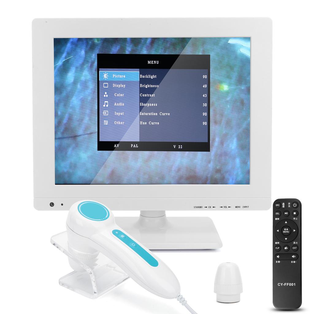 15 Inch 100X High Definition Scalp Detector Hair Follicle Analyzer Tester (100‑240V)EU Plug