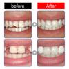 10/30ML Resin Tooth Repair Glue Shapeable Teeth Gaps Filling Solid Temporary Teeth Repair Falseteeth Glue Safety Broken Fangs