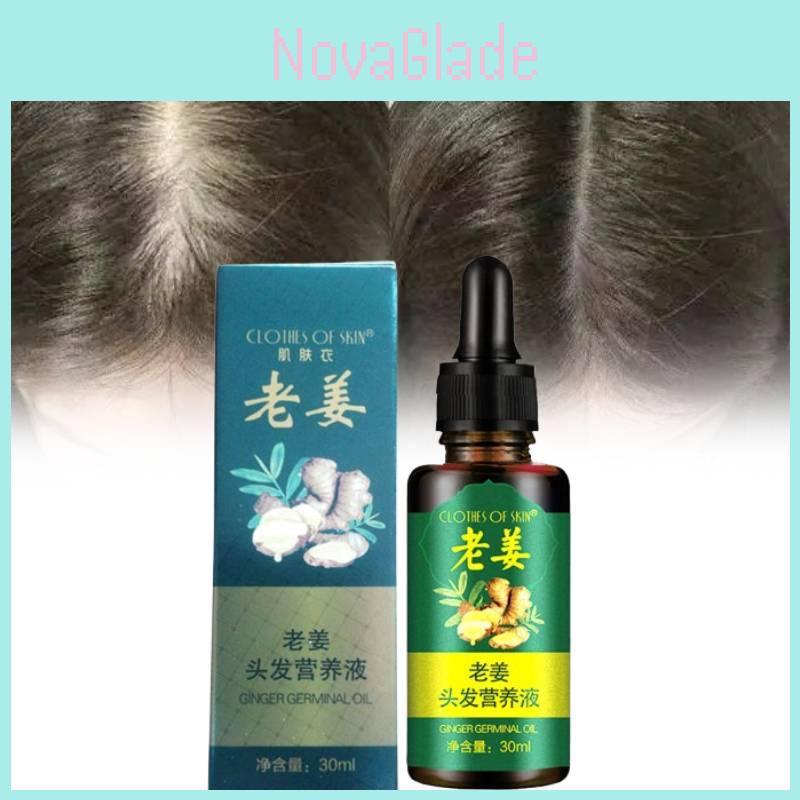 Nourishing Ginger Hair Essence For Healthy And Shiny Locks With Oil Control Benefits