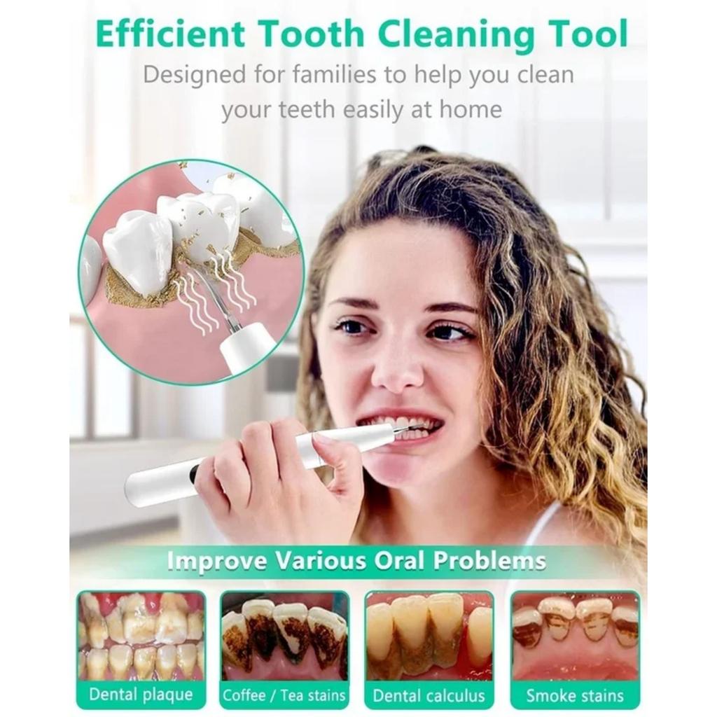 Electric Sonic Dental Calculus Scaler Oral Teeth Tartar Remover Plaque Stains Cleaner Removal Teeth Whitening Portable with LED