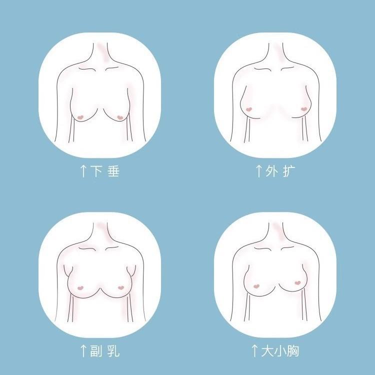 Adjustable bra, large chest, small underwear, closed breast, no steel ring lace, large size bra, women gather to prevent sagging