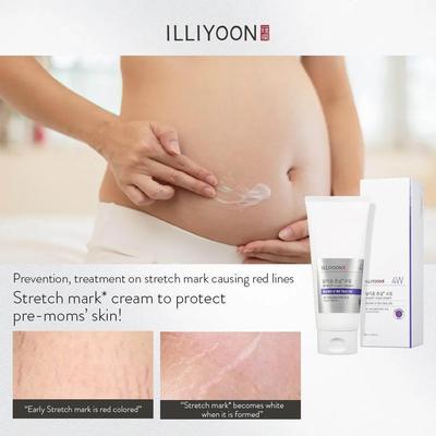 Stretch Mark Cream 200ml AUTHENTIC STORE