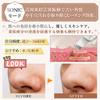 Facial Massager with EMS Microcurrent, 3-Color LED, Ultrasonic Vibration, Pore Cleansing, 3-Level Adjustable Temperature, Heat Therapy, Eye Care, and