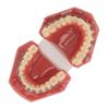 Dental Orthodontic Demonstration Model Teeth Model with Metal Wires and Bracket for Teaching Learning