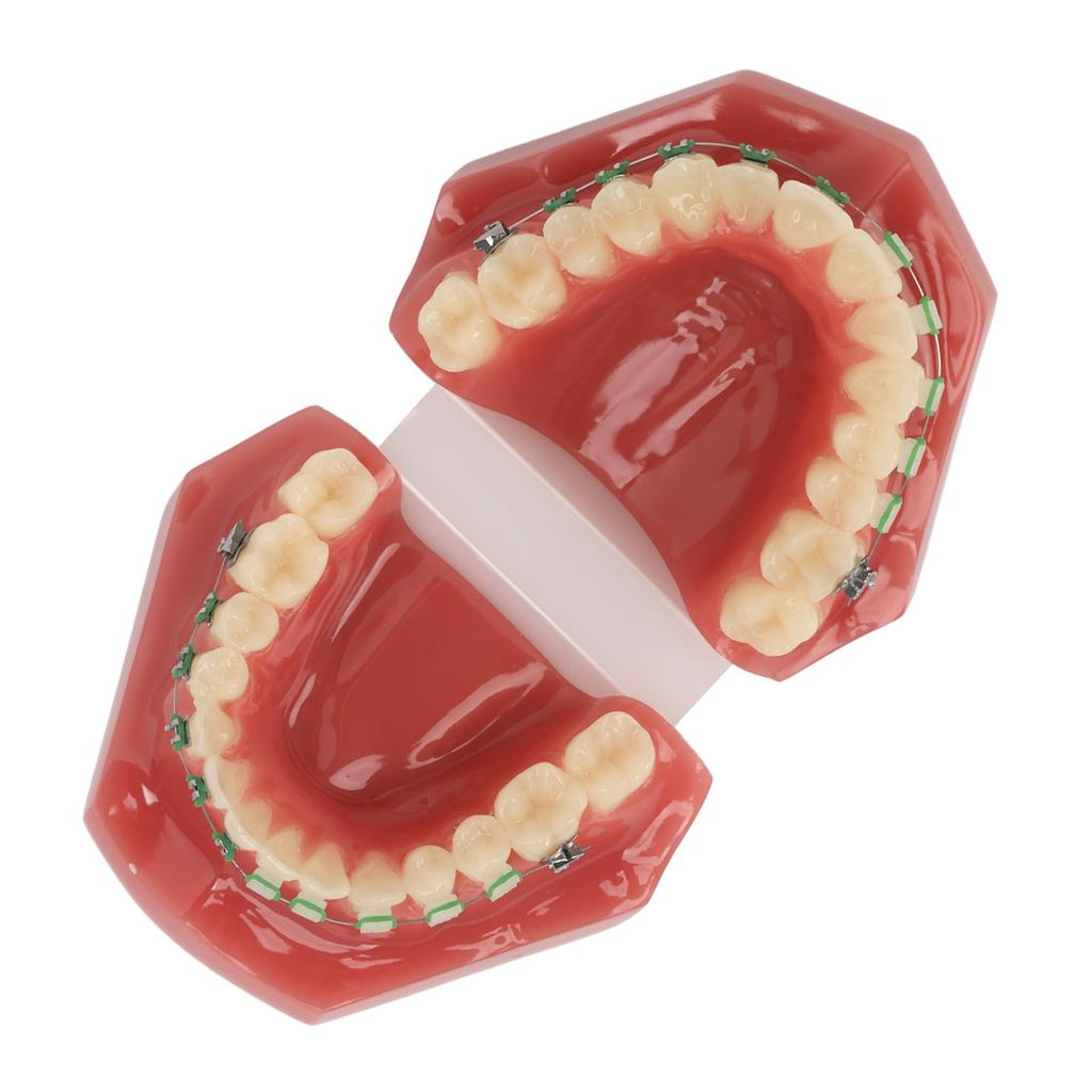 Dental Orthodontic Demonstration Model Teeth Model with Metal Wires and Bracket for Teaching Learning