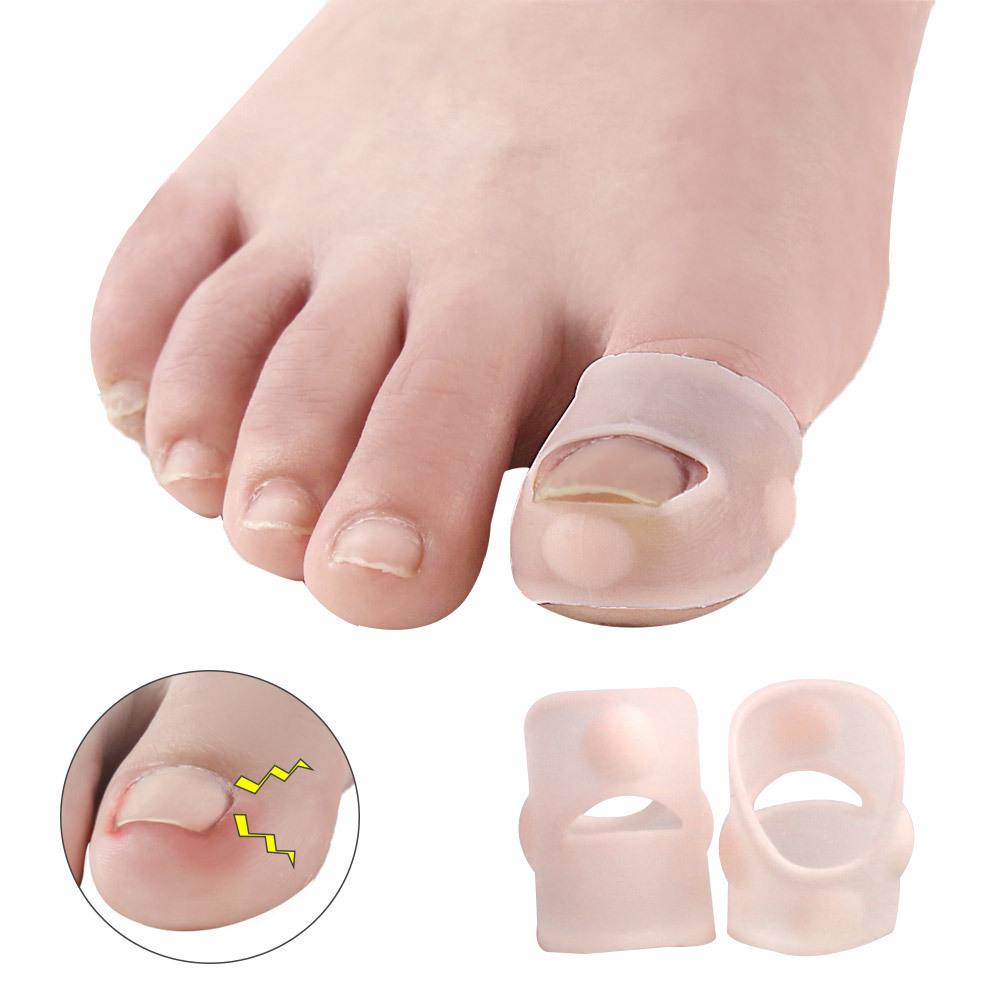 

Ingrown Nail Orthosis: Prevents Toenails and Fingernails from Growing into the Flesh Light Skin Tone