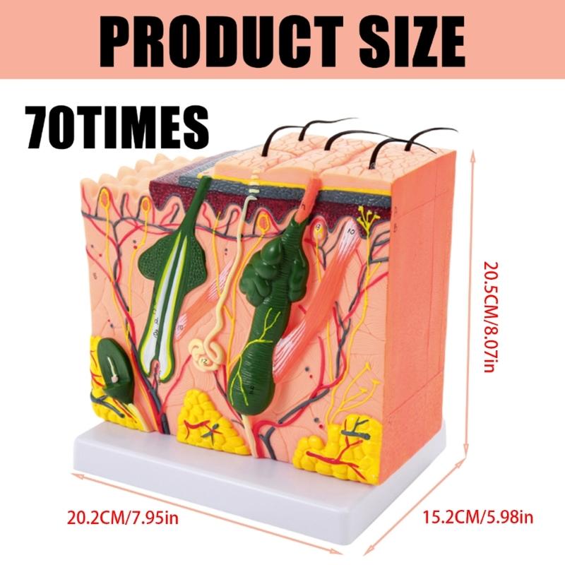 35/50/70/85X Enlarged Skin Model Skin Anatomical Model Teaching Tool for Classroom Study Display Teaching Medicals Model