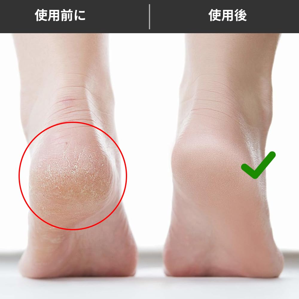 Reusable Foot Polishing Natural Volcanic Cuticle Foot Polishing Device for Soles and Pedicure Unisex Stone, Stone, Exfoliating, Removal, Heels,