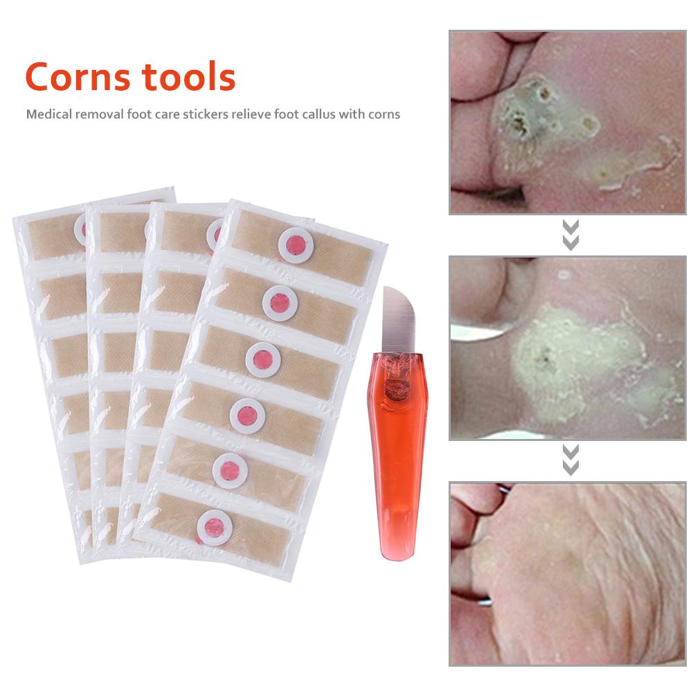 Купить 24 шт., наклейки для детоксикации мозолей на ногах, мозоли, шипы ...