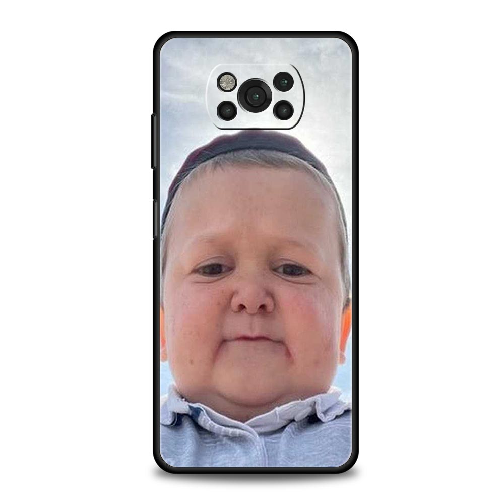 Funny Hasbulla Phone Case For Xiaomi Mi Poco X3 NFC M3 F4 F3 M4 X4 Pro 5G Note 10 12 Lite 11 11T 10T 11X 13 12T Pro 9T Cover