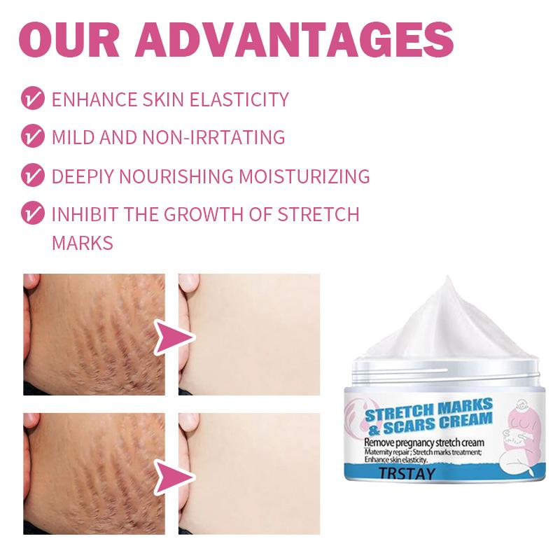 Pregnant Woman Stretch Mark Repair Cream Postpartum Repair and Fade Stretch Marks
