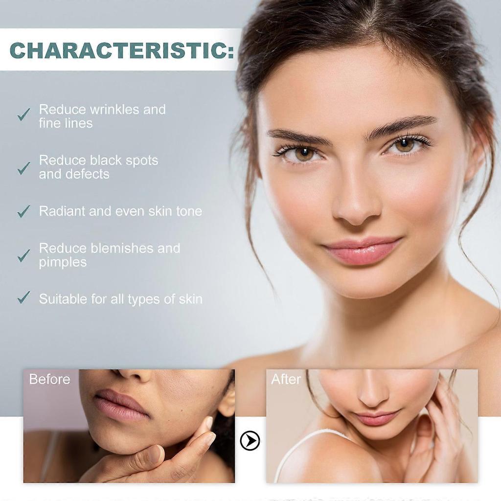 Retinol Serum, Anti-Aging Formula With Acetyl Hexapeptide-8 Sodium Hyaluronate And Vitamin C, Improve Dry & Dull Skin, Moisturizing Firming Serum