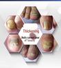 Electric Toenail Grinder & Polisher for Thick Nails