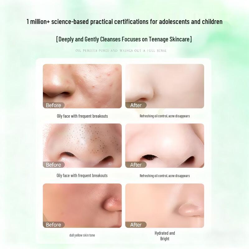 Fanyongchen Teen Facial Cleansers