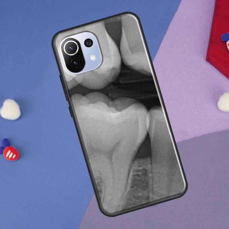 

Dentist Dental Dent Tooth Cover For Xiaomi 13 14 Ultra 11T 12T 13T 14T Pro POCO X7 Pro X3 X5 F3 F5 F6 M6 X6 Pro Case POCO X3 Pro