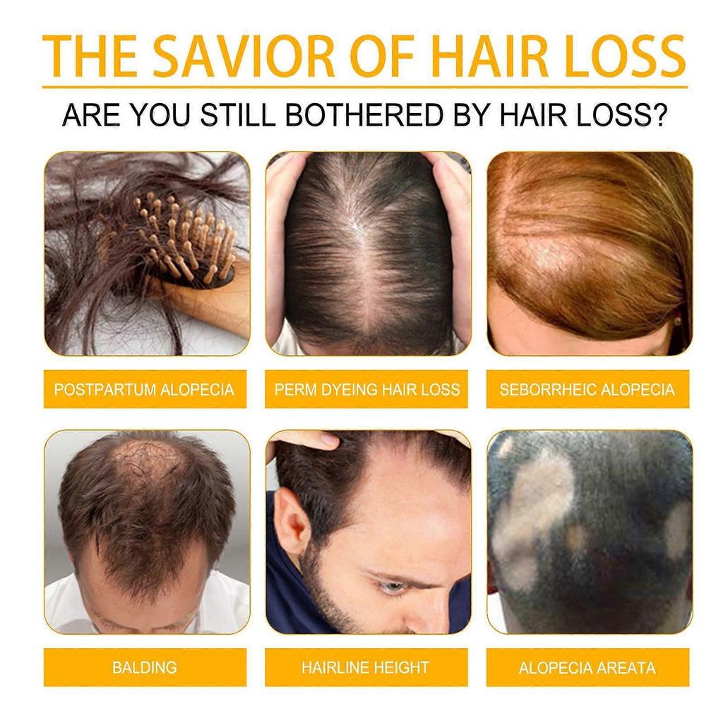 Biotin Hair Growth Spray: Strengthens, Prevents Hair Loss, Repairs, Nourishes, and Protects Hair Roots