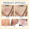 Bee Skin Care Cream, Moisturizing, Anti-aging, Firming, Gentle Skin Care, Moisturizing, Hydrating Skin Care