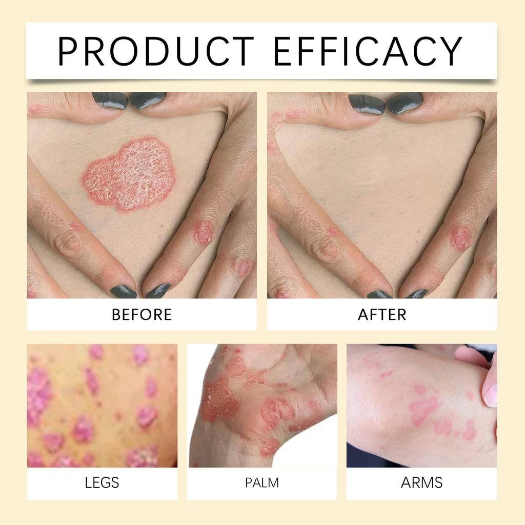 Bee Skin Care Cream, Moisturizing, Anti-aging, Firming, Gentle Skin Care, Moisturizing, Hydrating Skin Care