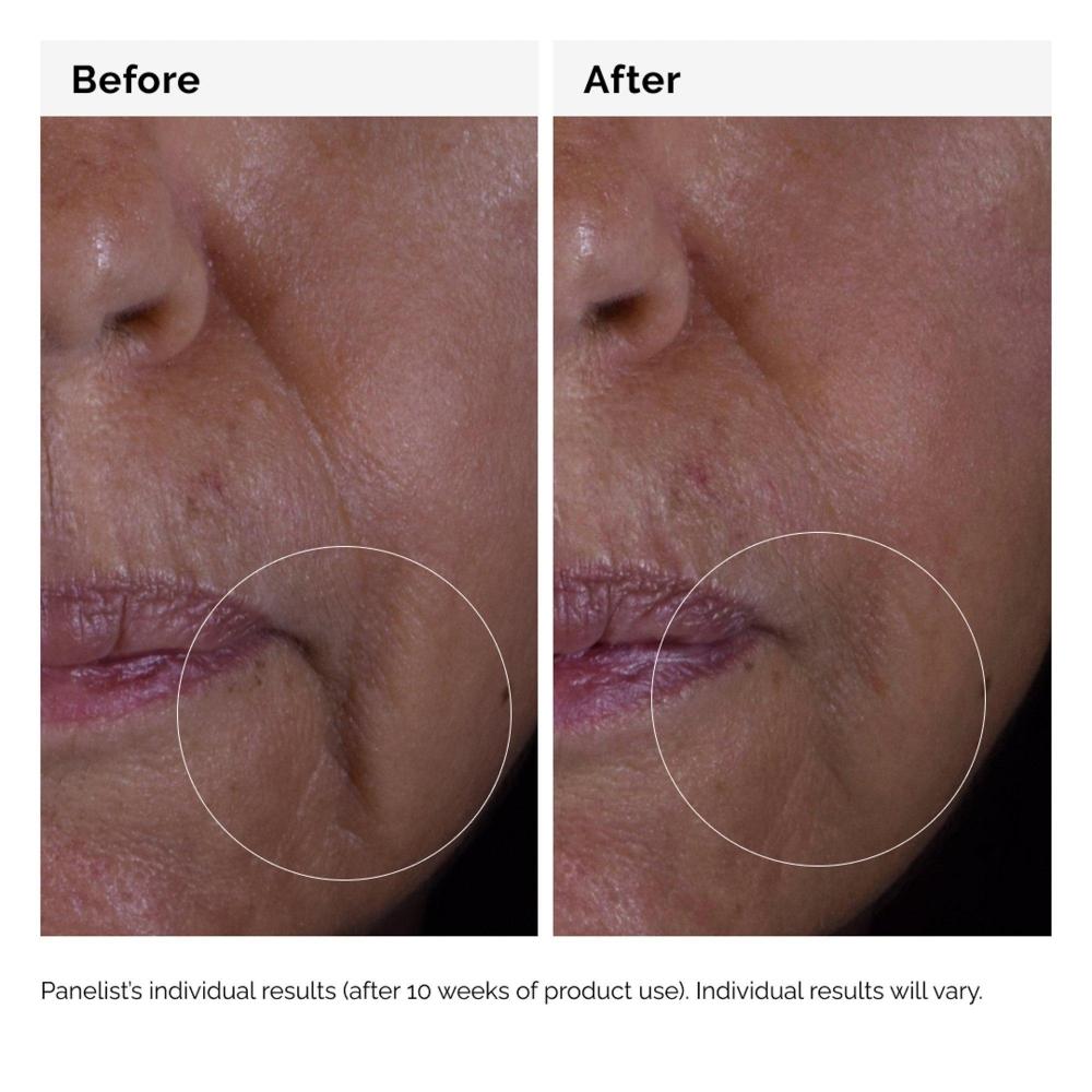 The Ordinary Gf 15  Serum For Visible Skin Repair And Wrinkles 1.0 Oz