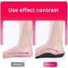 1 Pair Arch Support Insoles Shock Absorption Orthopedic Flatfoot Pad Comfort Ankle Stabilization Corrective Support Universal Foot Pad for Sports