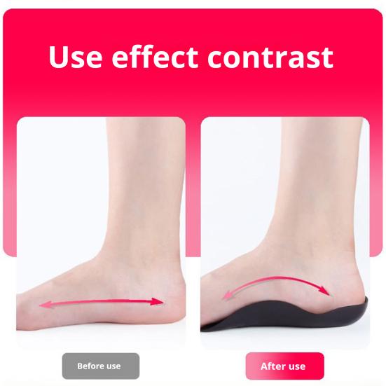 1 Pair Arch Support Insoles Shock Absorption Orthopedic Flatfoot Pad Comfort Ankle Stabilization Corrective Support Universal Foot Pad
