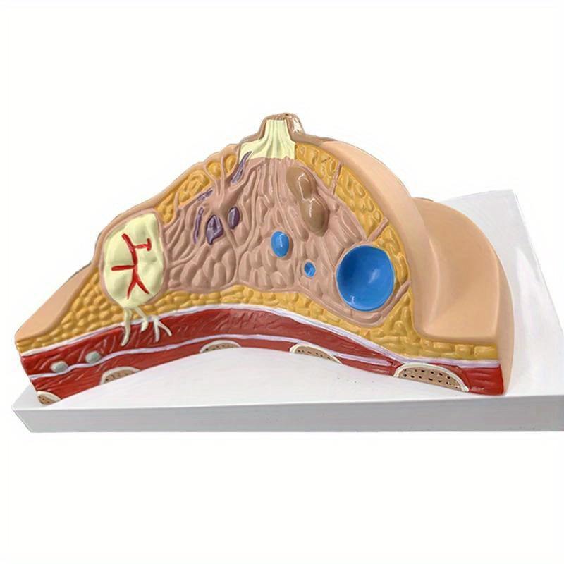 Breast Lesion Model Human Female Quiescent Breast Anatomy Model Environmentally Friendly Medical Teaching Display Model