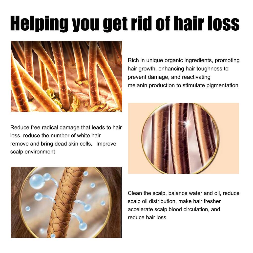 East Moon Haarwachstumsserum für Männer 30ml - Gegen Haarausfall, Stärkt das Haar, Fördert das Haarwachstum, Feuchtigkeitsspendende Haarkur