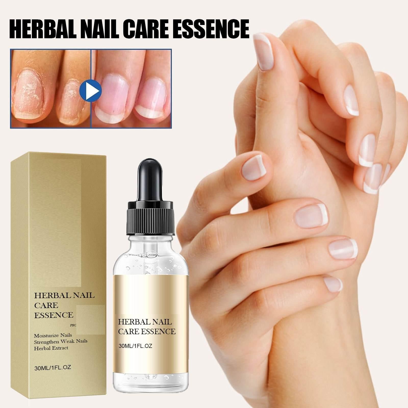 

Herbal Care Essence, Nail Care Essence, Onychomycosis Care Essence, For Weak And Damaged Nails, Nail Strengthening Essence,30ML