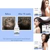 B3014 Hair Growth Concentrate Serum For Home Use With Luxurious Packaging For All Hair Types