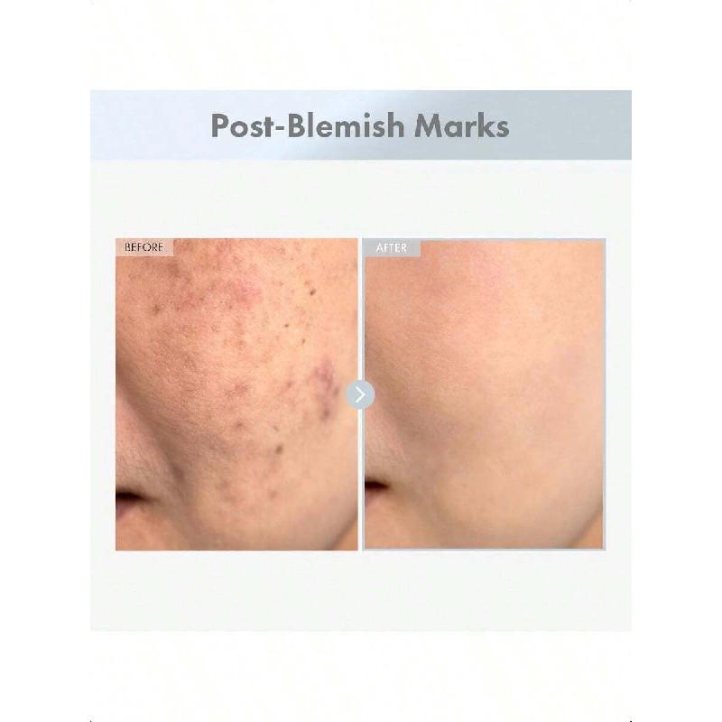 Tosowoong Niacinamid 15% Pleťové sérum 30ml | Vysoká účinnost 150 100 ppm Niacinamid & Kyselina tranexamová Směs, Složení pro korekci tmavých skvrn