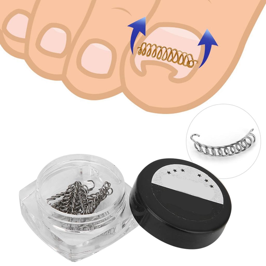 2Box Ingrown Fixer Wire Toenail Correction Nail Ingrowing Corrector Pedicure Care Tool