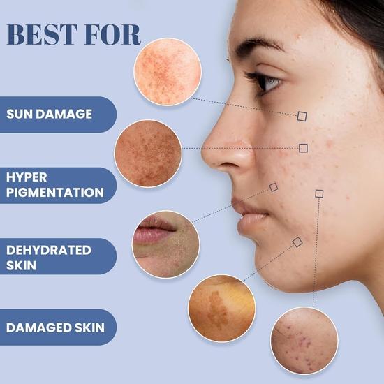 WildOak 5% Vitamin C | Reduces Acne Scars, Hyperpigmentation & Dullness | Repairs & Hydrates Skin | Lightweight, Non-Greasy Formula | 100ml