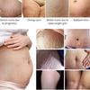 Pregnancy Repair Cream Stretch Removal Easy to Absorb Natural Extracts Skin Scar Remove Cream for Mother