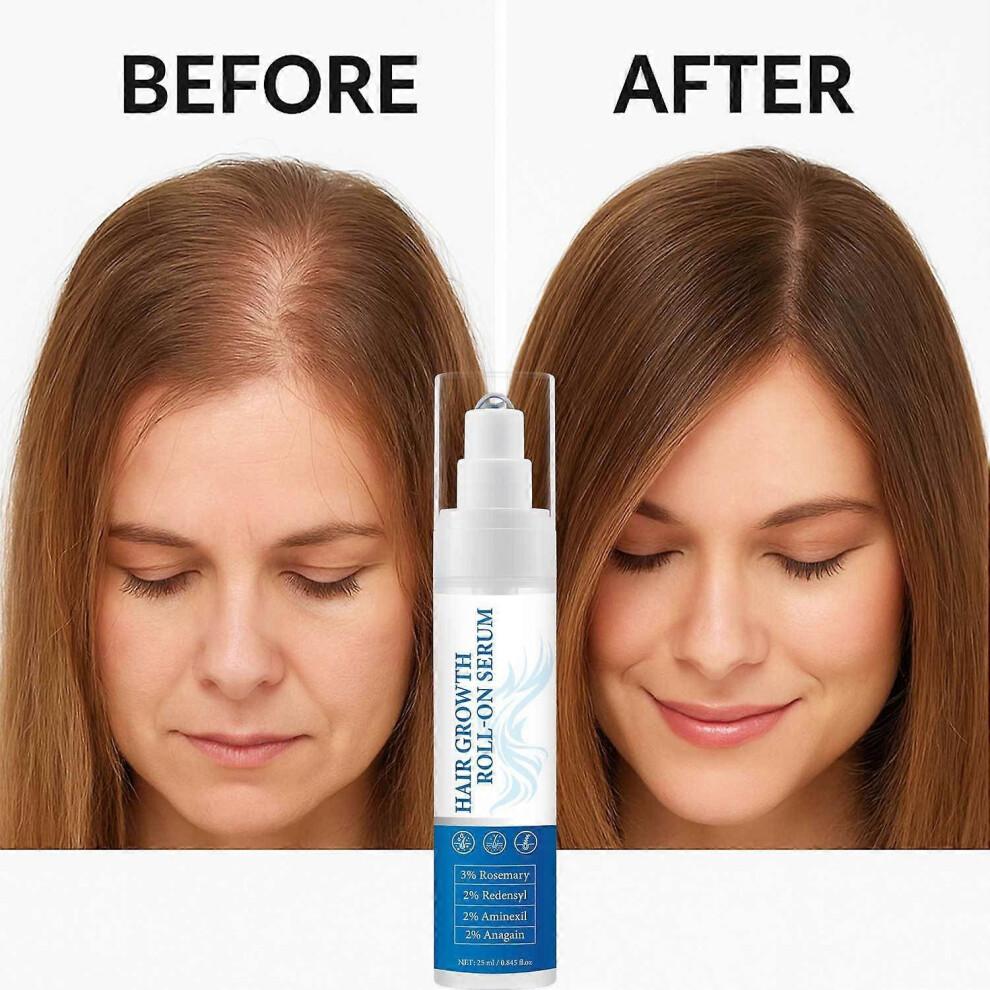 Hair Growth Serum Roll On - 3% Rosemary, 3% Redensyl & 2% - (25ml)