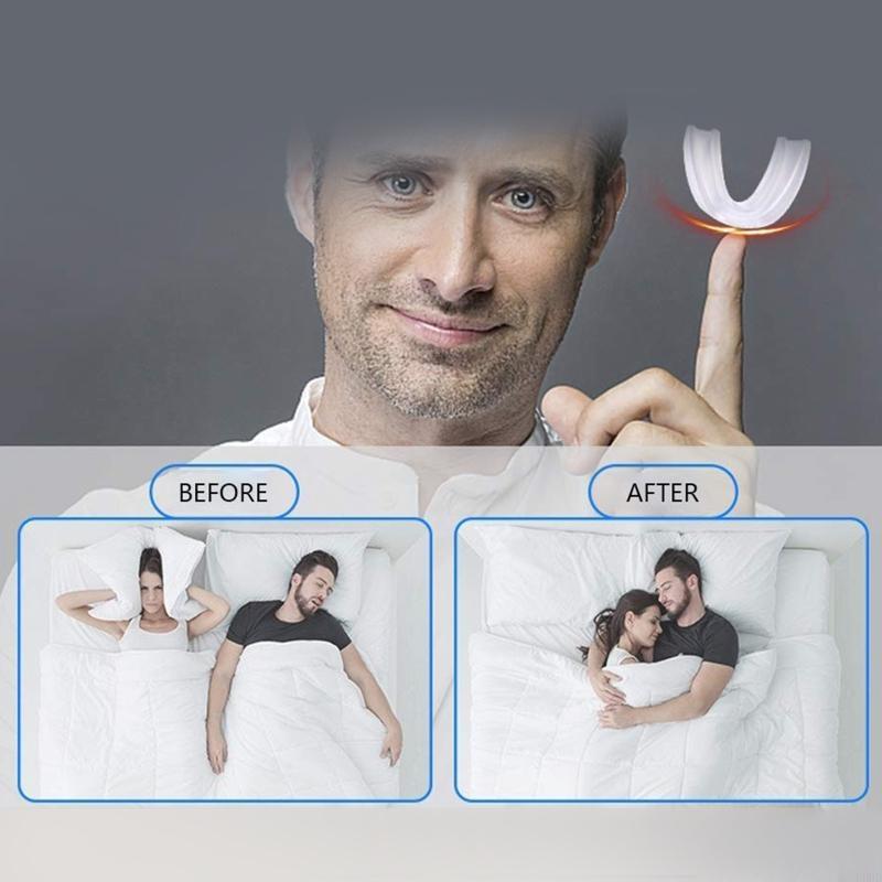 E0BD Anti-Snoring Braces Anti Molar Braces Protect Teeth Protective Cover Mouth Guard Adjustable for Men Women