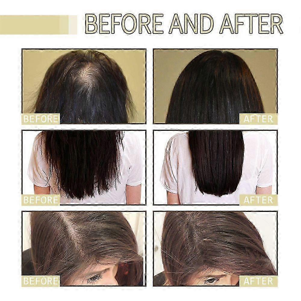3Pcs Natural Hair Growth Oil, Veganic Organic Natural Hair Growth Oil 60ml