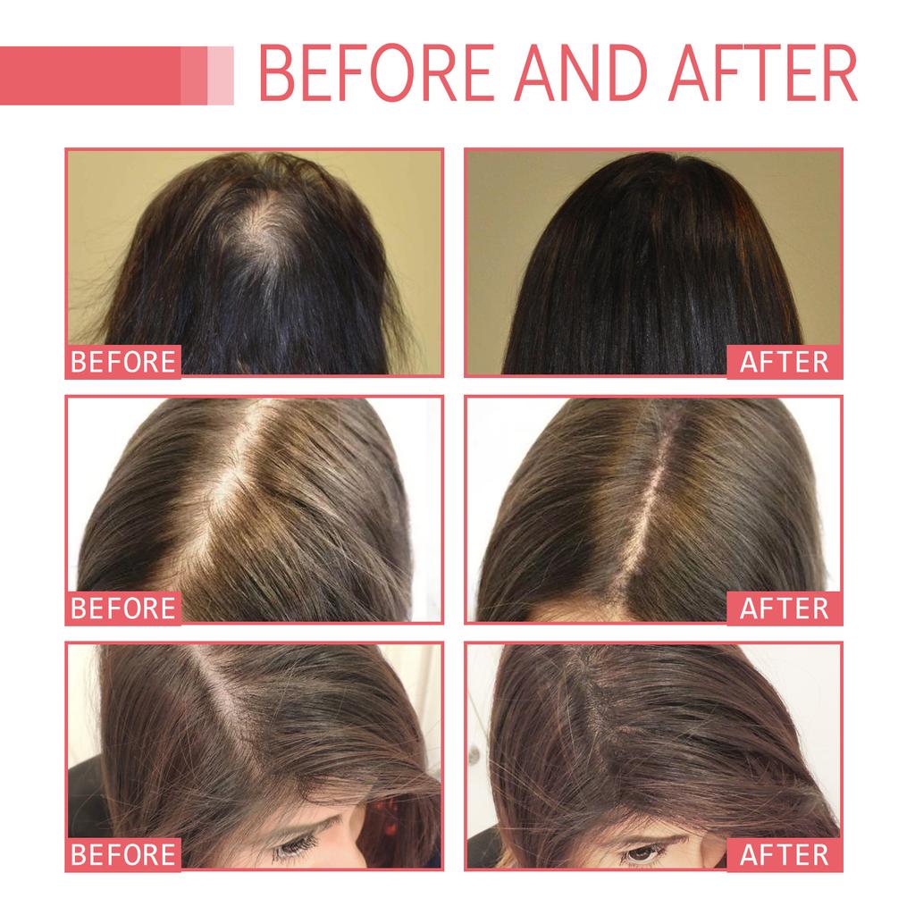 Hair Care Essential Oil, Moisturizes Hair Roots, Thickens & Strengthens Hair, Improves Dry & Frizzy Hair, Effective Hair Protection & Stabilization
