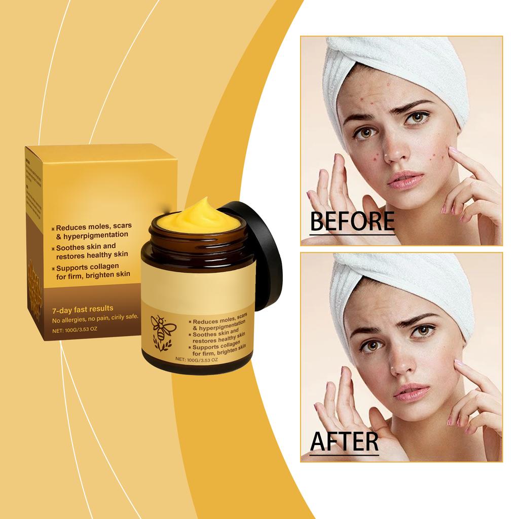 Bienenhautcreme hellt Pigmentierung auf, strafft, spendet Feuchtigkeit und lässt den Teint strahlen.. Hautcreme