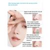 Deep Cleansing Blackhead and Whitehead Removal Tool for Nose and Face - Skin Pore Cleaner Skin Care Beauty Tools Hot Sale