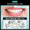 Whitening Gel in 60g x Intensive Whitening Removes Teeth Stain and Prevents Tartar Gel 60141 Dr.Oral (2-Pack) [Made Japan] Mint, 2, Gel, Toothpaste,