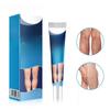 SOL LORA Varicose Vein Repair Cream – Relieves Leg Swelling & Bulging Veins
