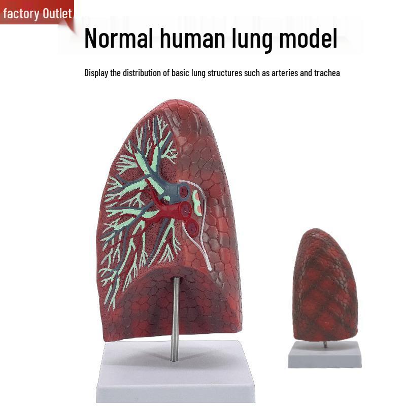 Human Lung Anatomy Model for Teaching: Normal Lung and Bronchus