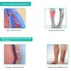 Medical Elastic Compression Stockings Varicose Veins Stockings Leg Slimming