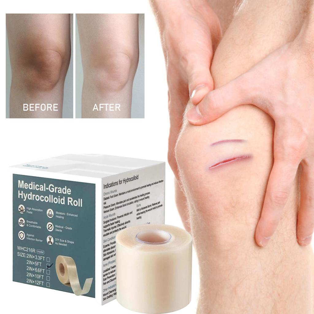 Hydrocolloid Roll For Cut To Size, Extra Large Hydrocolloid Patch Bandages With Self-Adhesive, Ultra Absorbent, Flexible, Aid Kit
