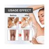 2 Pezzi Crema Naturale per la Cura della Pelle per Ascelle, Collo, Ginocchia, Gomiti, Interno Coscia