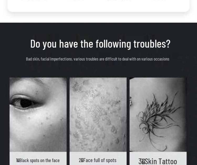 Portable Picosecond Laser Pen for Tattoo, Freckle, and Eyebrow Removal with Red & Blue Light