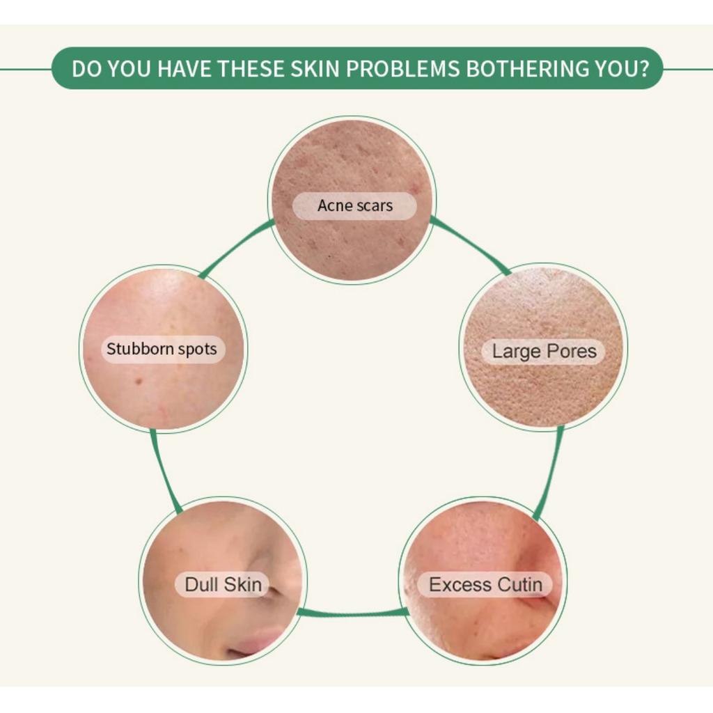 Feuchtigkeitsspendende und Feuchtigkeitsspendende Gesichtsmaske