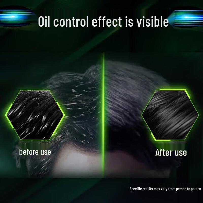 Clear Men Anti-Dandruff Oil Control Shampoo