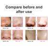 Multi-Functional Cleaning Blackhead Remover Pore Acne Pimple Removal Face T Zone Nose Cleaner Vacuum Suction Facial Beauty Devi